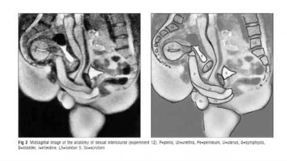 Modèle de crayon du vagin