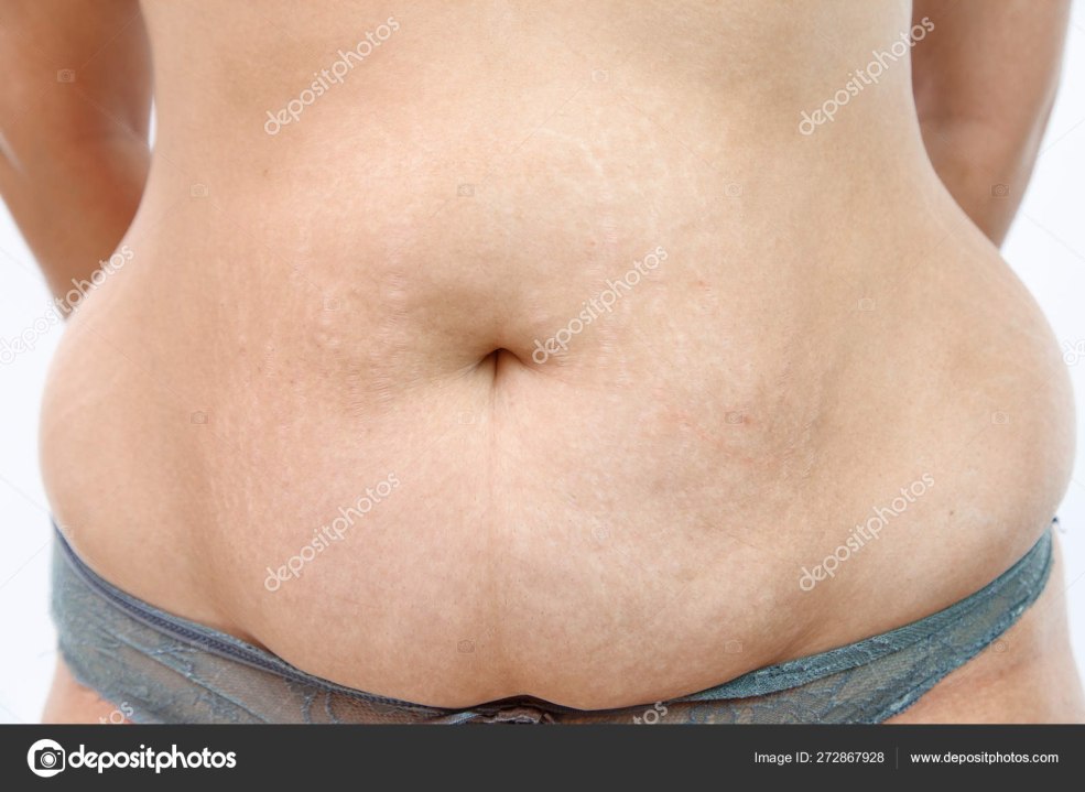 Seins en lambeaux connexes