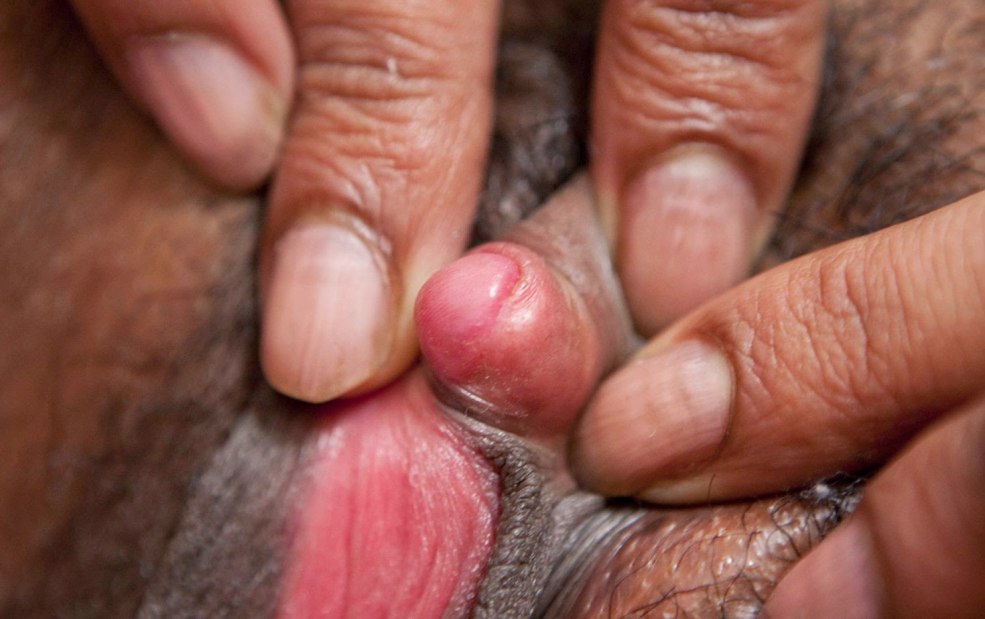 Fille avec un long clitoris