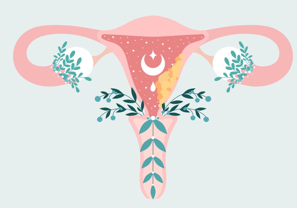 Gynécologie de la santé féminine