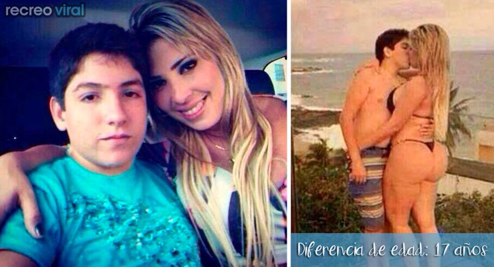 Histologie du carcinome de mammier