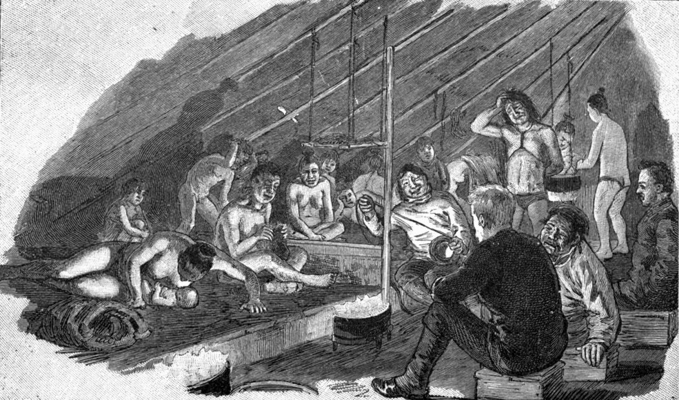 Porno-érotique eskimoskoy