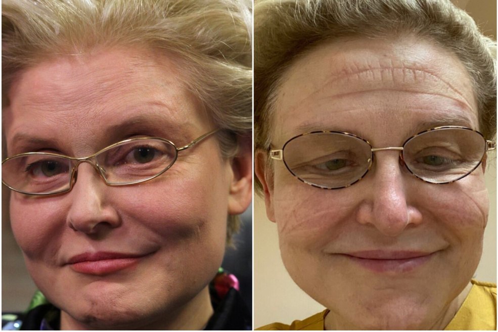 Malinhev sans maquillage