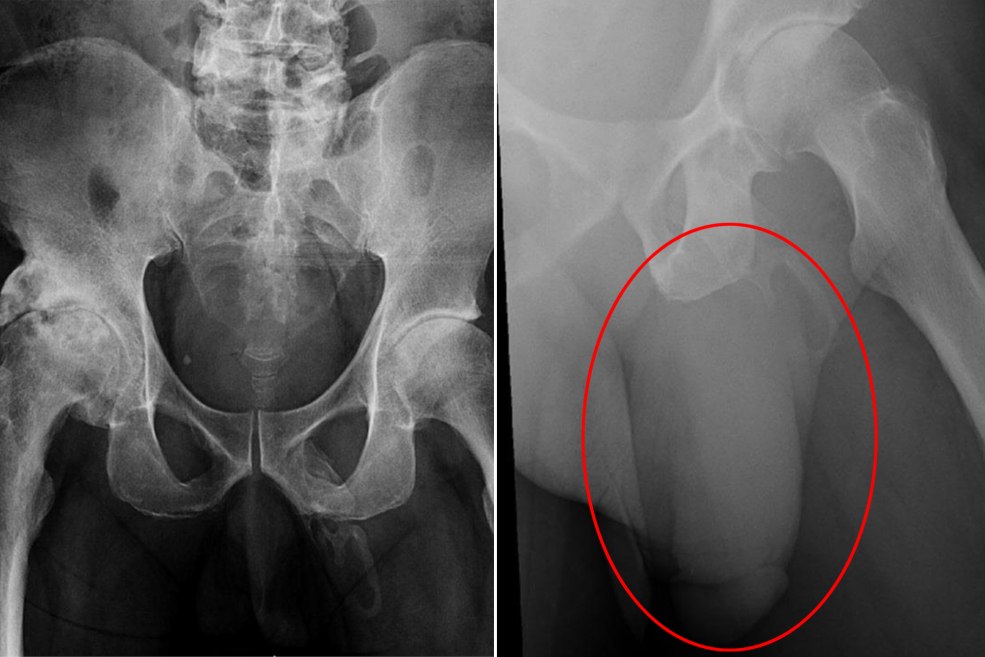 Jeune nègre avec un grand membre