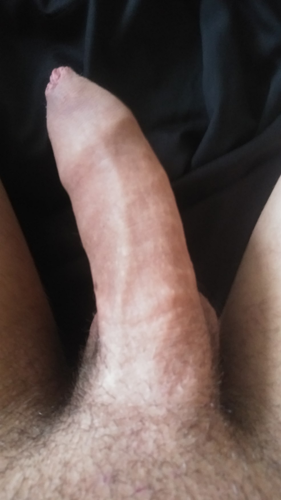 Organe génital masculin excité