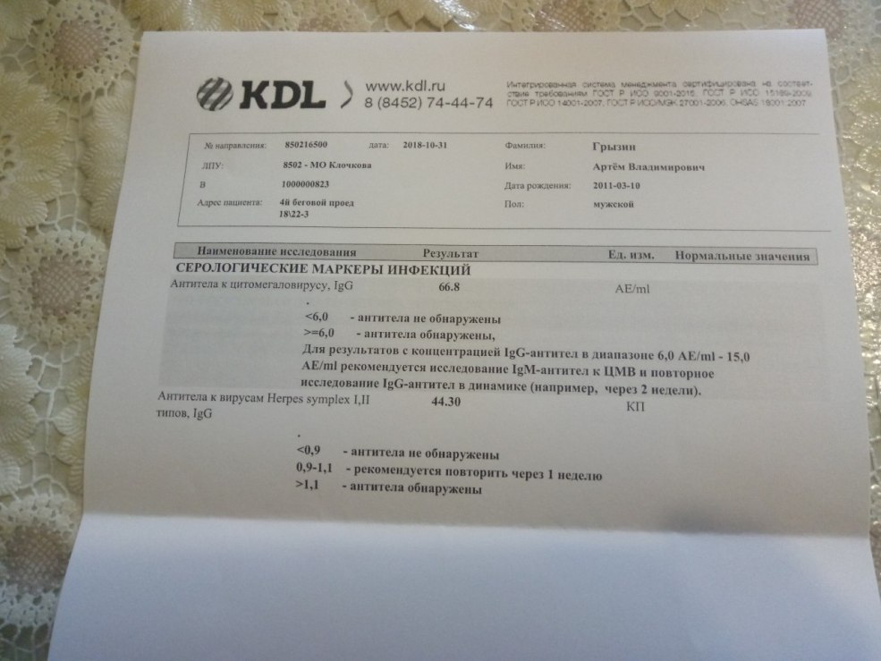 Analyse de décodage pour les anticorps KDL
