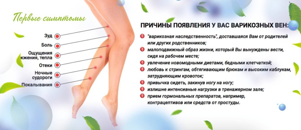 Varices