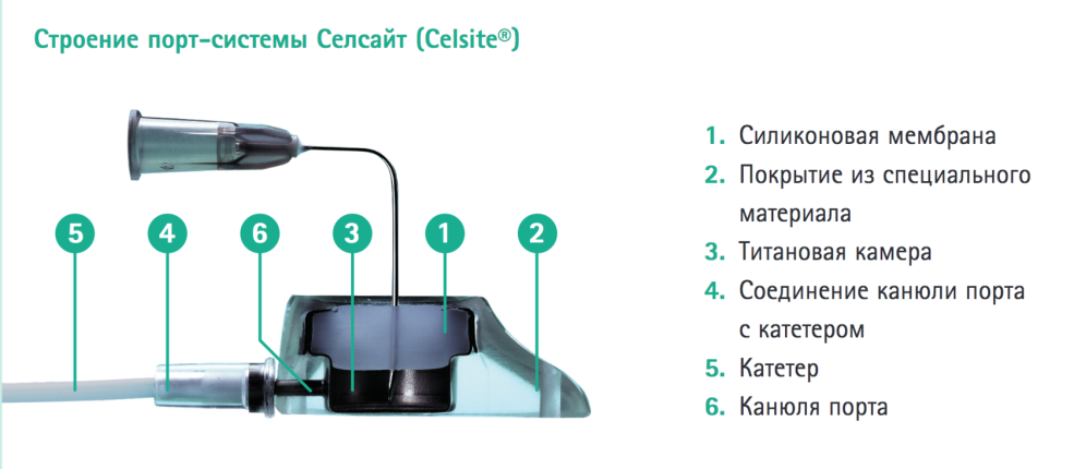 Cathéter pour un compte-gouttes