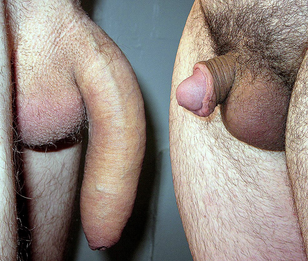 Membre masculin sans érection
