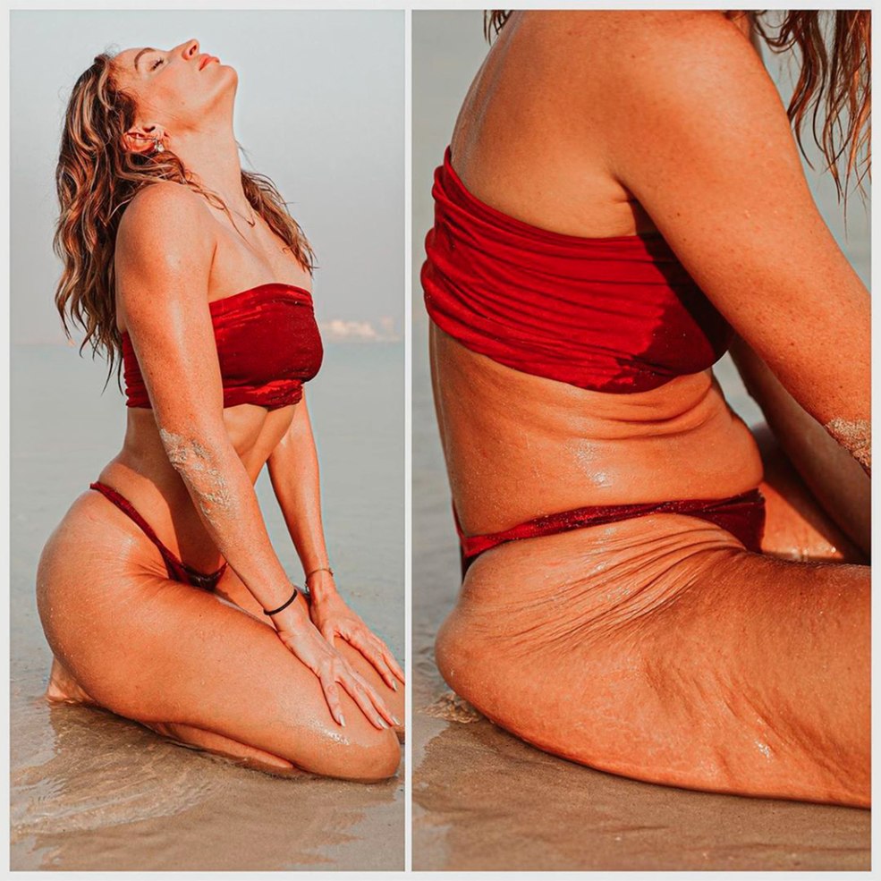Belles femmes avec de la cellulite
