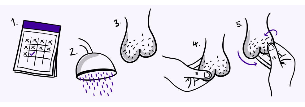 Hémicoctomie totale