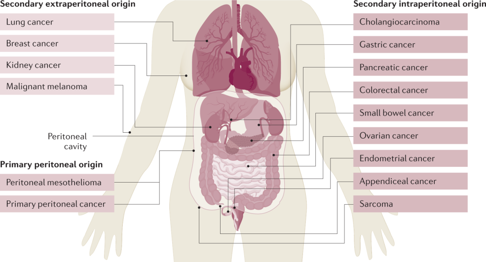 Quelle peut être le PSA dans la maladie de la prostate?