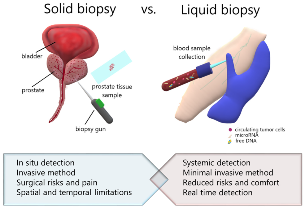 Calculateur de charge du cancer résiduel