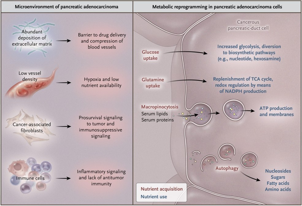 Patient de cholangiocarcinome