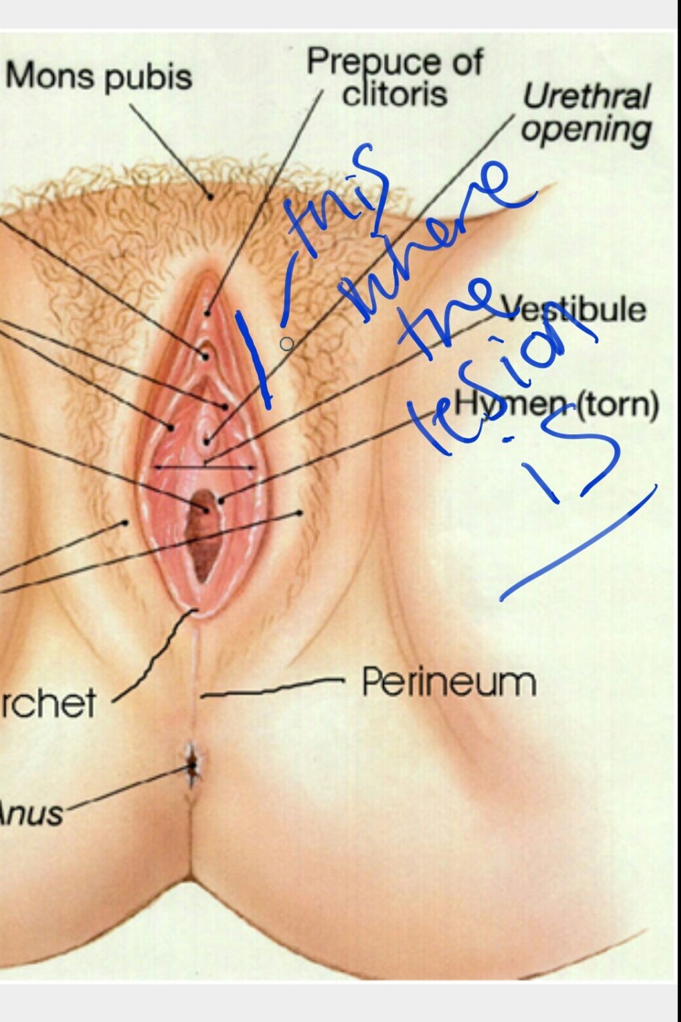 L'emplacement du clitoris chez les femmes