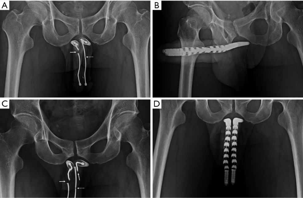 Docteur femme examine le pénis