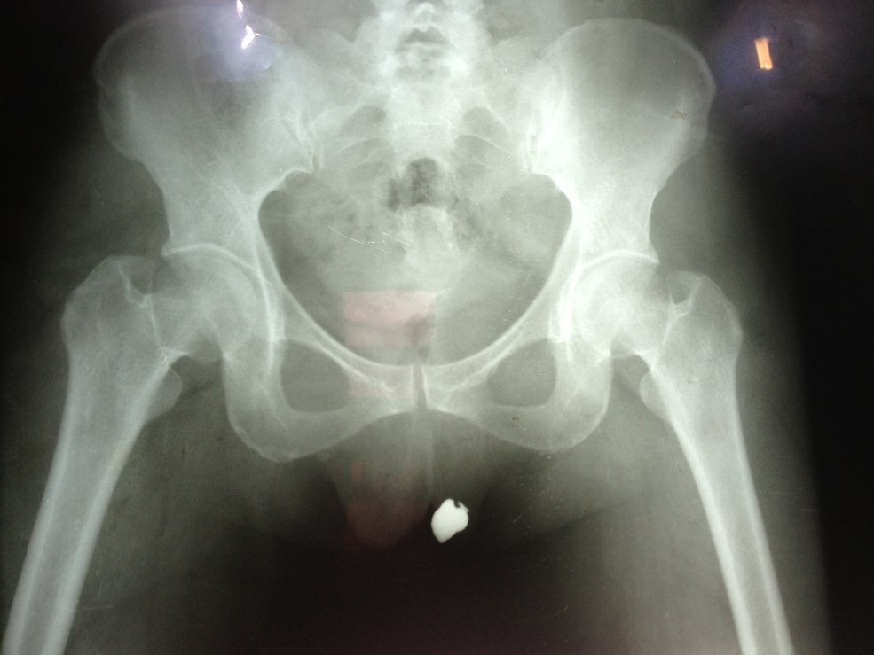 Tête de lit fonctionnelle pour le lit