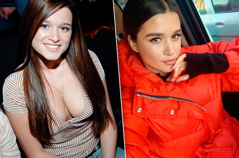 Borodin à l'augmentation mammaire