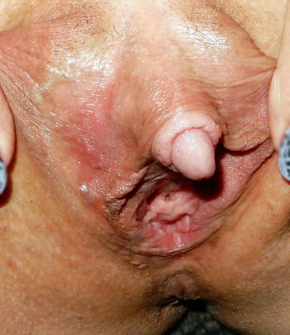 Clitoris long des athlètes