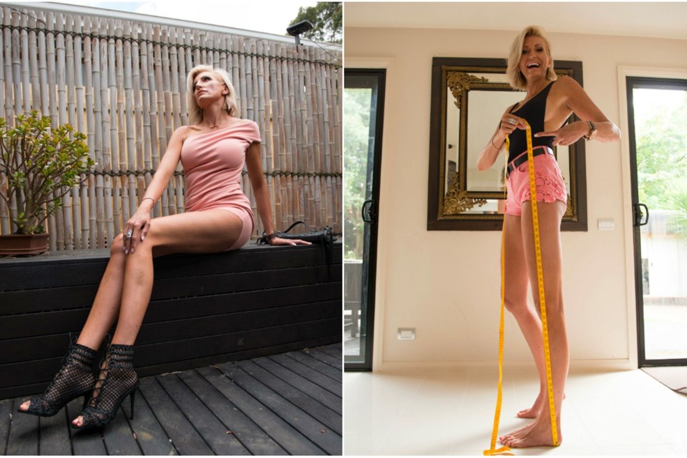 Karolin Arthur les jambes les plus longues