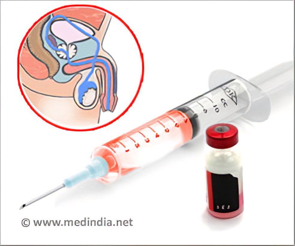 Un énorme pénis épais