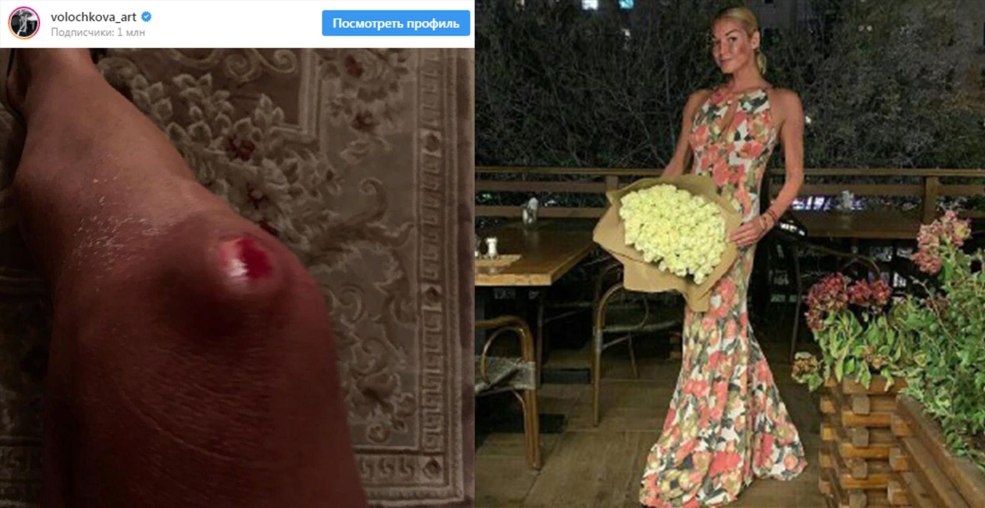 Volochkova a été retiré dans la rue